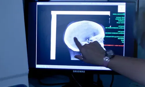 Radiology Tech in 佛罗里达 Examining X-Ray